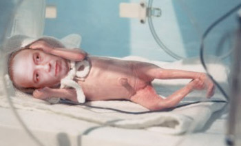 santana e a incubadora.jpg